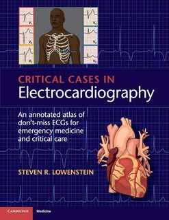 Foto 1 | Foto 1 | Libro: Cambridge University Press: Casos Críticos En Electrocardiografía - Venta Internacional.