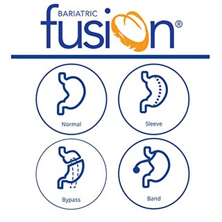 Foto 5 | Foto 5 | Suplemento Bariatric Fusion Iron Cherry de 60 Tabletas-Venta Internacional