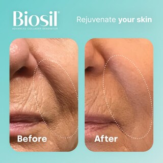 Foto 5 | Foto 5 | Suplemento Biosil Collagen Generator 120 Cápsulas X2 120 Días - Venta Internacional.