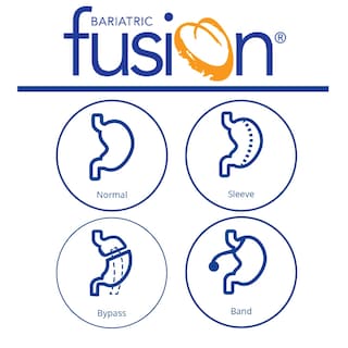 Foto 7 | Foto 7 | Suplemento Multivitamínico Bariátrico Bariatric Fusion 60 Cápsulas - Venta Internacional