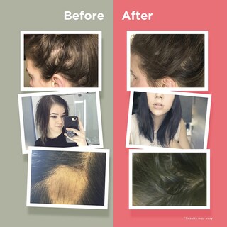 Foto 5 | Foto 5 | Vitaminas Para El Crecimiento Del Cabello Naturenetics Hairanew 60 Cápsulas - Venta Internacional.