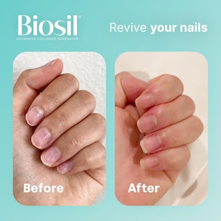 Foto 5 | Foto 5 | Suplemento Biosil Collagen Generator 60 Cápsulas Líquidas - Venta Internacional.