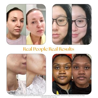 Foto 3 | Foto 3 | Suplemento HAIRtamin Skintamin de Colágeno Vegetariano Paquete de 3 Frascos con 30 Cápsulas C/U - Venta Internacional