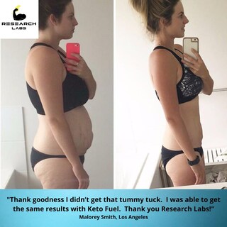 Foto 3 | Foto 3 | Píldoras Dietéticas Cetogénicas Supplement Research Labs Con Vinagre De Sidra De Manzana - Venta Internacional.