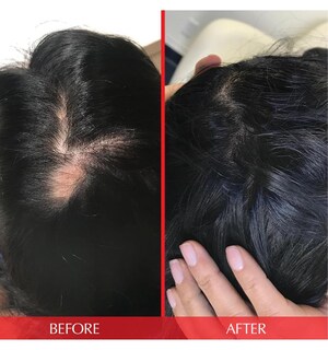 Foto 5 | Foto 5 | Vitaminas Para El Cabello Hairtamin Advanced Formula 30 Cápsulas - Venta Internacional.