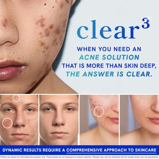 Foto 2 | Foto 2 | Suplemento Smnutrition Clear Skin Acne Con Zinc Dim Y Probióticos - Venta Internacional.