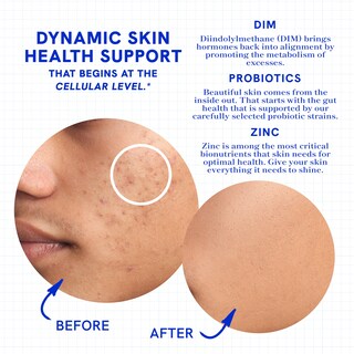 Foto 4 | Foto 4 | Suplemento Smnutrition Clear Skin Acne Con Zinc Dim Y Probióticos - Venta Internacional.