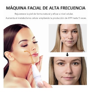 Foto 3 | Foto 3 | Máquina de Terapia de Alta Frecuencia para la Piel