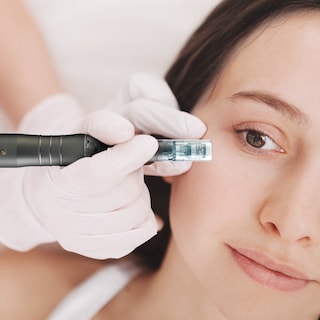 Foto 3 | Foto 3 | Derma Pen Beauty Ultima M8 Con Cartuchos Eu Black Skin Care - Venta Internacional.