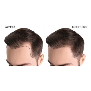 Foto 4 | Foto 4 | Kit X3 Crecimiento Cabello Sistema Capilar The Shaving Co