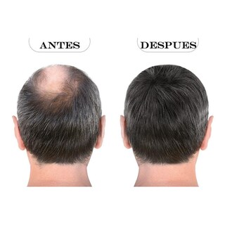 Foto 7 | Foto 7 | Kit X3 Crecimiento Cabello Sistema Capilar The Shaving Co