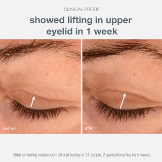 Foto 6 | Foto 6 | Crema De Ojos Dermalogica Phyto Nature Lifting Que Reduce Las Arrugas - Venta Internacional.