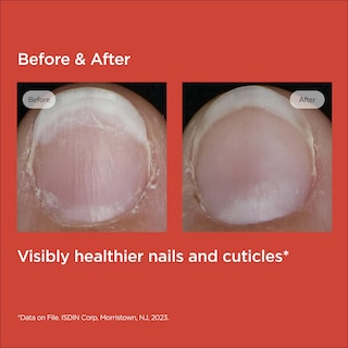 Foto 5 | Foto 5 | Sérum Fortalecedor De Uñas Para Cutículas Isdin Si-nails - Venta Internacional.