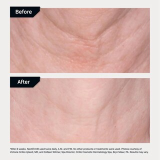Foto 5 | Foto 5 | Crema Reafirmante Para El Cuello Revision Skincare Nectifirm  Antienvejecimiento 240 Ml - Venta Internacional.