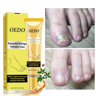 Foto 1 | Foto 1 | El Aceite Esencial Para El Cuidado De Las Uñas Huoguo Previene El Crecimiento De Hongos 15 Ml - Venta Internacional.