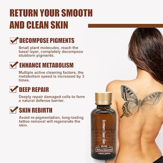 Foto 4 | Foto 4 | El Eliminador De Tatuajes Huoguo 30 Ml Puede Eliminar Tatuajes De Manera Efectiva - Venta Internacional.