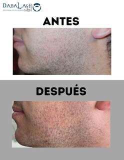 Foto 3 | Foto 3 | Suero Para Pestañas, Cejas Y Barba Dabalash Men De 5.32 Ml