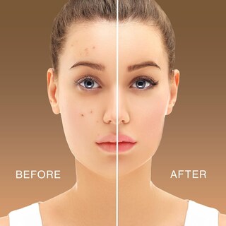 Foto 5 | Foto 5 | Concealer L.a. Girl Pro Conceal Hd Warm Sand, 8 Ml - Venta Internacional.