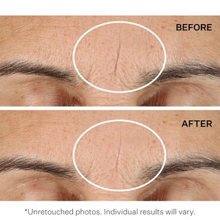 Foto 3 | Foto 3 | Primer Strivectin Line Blurfector Instant Wrinkle 30 Ml - Venta Internacional