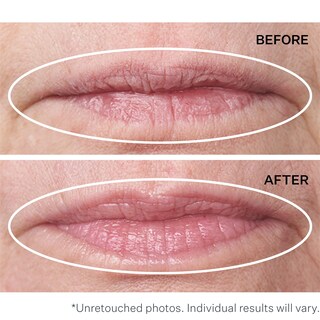 Foto 5 | Foto 5 | Tratamiento Strivectin Antiarrugas Double Fix Para Labios - Venta Internacional.