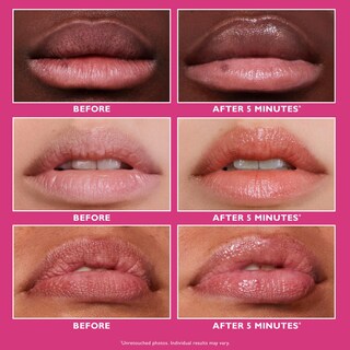 Foto 3 | Foto 3 | Tratamiento Para Labios Con Relleno Y Relleno De Labios Peter Thomas Roth - Venta Internacional.
