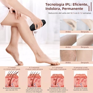Foto 5 | Foto 5 | Depiladora Láser de Luz Ipl Permanente Belug color Negro