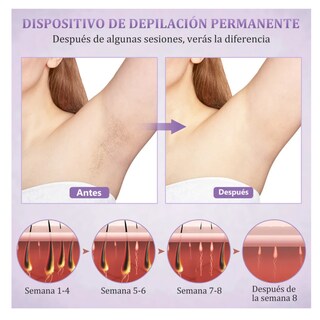 Foto 3 | Foto 3 | Depiladora Láser Corporal Modo Frio Color Violeta 127v, Lab.g