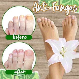 Foto 3 | Foto 3 | Tabletas Para Remojar Los Pies Huoguo Exfoliantes Antimicóticos Cuidado De Los Pies - Venta Internacional.