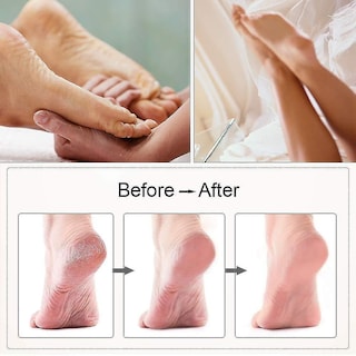 Foto 3 | Foto 3 | Herramienta Eléctrica Para Pedicura Con Lima Para Pies Huoguo Usb De Tres Velocidades - Venta Internacional.