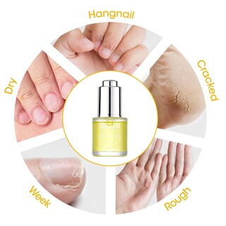 Foto 4 | Foto 4 | Aceite Para Uñas Y Cutículas, Gel Para El Crecimiento, Hidratante, 20 Ml - Venta Internacional.