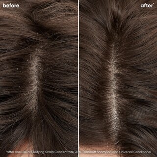 Foto 3 | Foto 3 | Acondicionador Biolage Scalp Sync Universal Lightweight 400 Ml - Venta Internacional