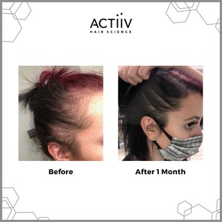 Foto 2 | Foto 2 | Acondicionador Actiiv Recover Para Engrosar La Caída Del Cabello, 473 Ml - Venta Internacional.