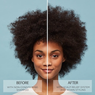 Foto 5 | Foto 5 | Acondicionador Nioxin Scalp Relief Sensitive Dry Itchy 200 Ml - Venta Internacional.