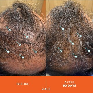 Foto 3 | Foto 3 | Acondicionador Ds Laboratories Revita Hair Growth 190 Ml - Venta Internacional.