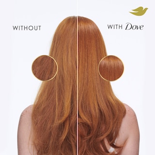 Foto 5 | Foto 5 | Acondicionador Dove Daily Moisture Para Cabello Seco 828 Ml - Venta Internacional.