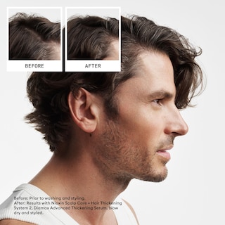 Foto 3 | Foto 3 | Champú Y Acondicionador Nioxin System 2 1l Para Cabello Fino - Venta Internacional.