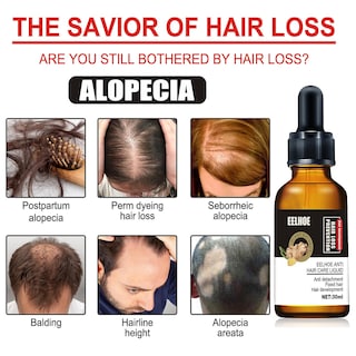 Foto 2 | Foto 2 | Aceite Esencial Para El Crecimiento Del Cabello Huoguo Plant Anticaída  30 Ml - Venta Internacional.