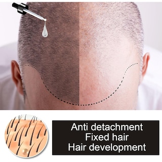 Foto 4 | Foto 4 | Aceite Esencial Para El Crecimiento Del Cabello Huoguo Plant Anticaída  30 Ml - Venta Internacional.