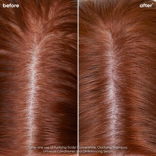 Foto 2 | Foto 2 | Sérum Biolage Scalp Sync Oil Equilibrante para Cuero Cabelludo Graso - Venta Internacional