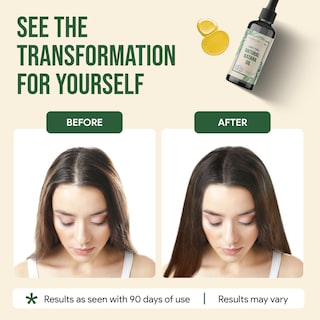 Foto 2 | Foto 2 | Aceite De Batana Morstar Para El Crecimiento Del Cabello, 100 Ml - Venta Internacional.