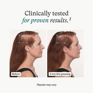 Foto 4 | Foto 4 | Venta Internacional - Suplementos Nutrafol para el Crecimiento del Cabello a Partir de 45 Años