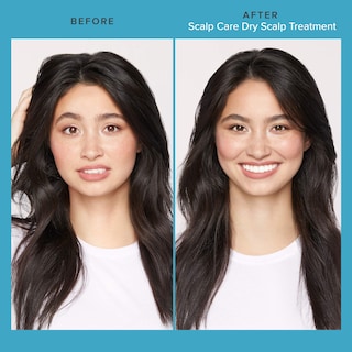 Foto 2 | Foto 2 | Tratamiento Para Cuero Cabelludo Seco Living Proof Scalp Care Hydration - Venta Internacional.