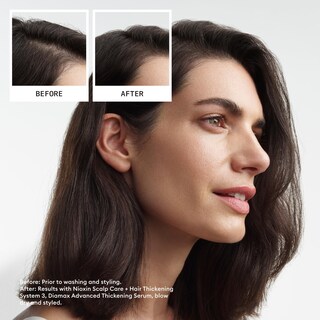 Foto 3 | Foto 3 | Champú Y Acondicionador Nioxin System 3 1l Para Cabello Teñido - Venta Internacional.