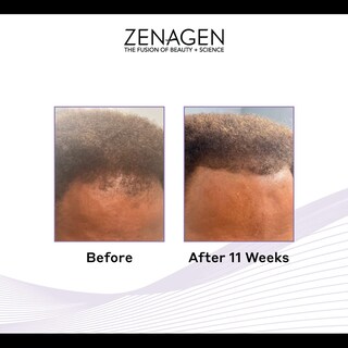 Foto 3 | Foto 3 | Tratamiento Anticaída Zenagen Revolve Thickening 480 Ml Para Hombres - Venta Internacional.