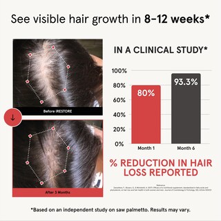 Foto 2 | Foto 2 | Suplemento Para El Crecimiento Del Cabello Irestore Con Biotina Y Bloqueador De Dht 30d - Venta Internacional.