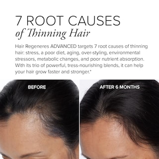 Foto 3 | Foto 3 | Suplemento Serovital Hair Regeneres Advanced 90 Comprimidos - Venta Internacional.