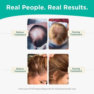 Foto 5 | Foto 5 | Acondicionador Anticaída Shapiro Md Dht Para Combatir La Caída Del Cabello, Suministro De 2 Meses - Venta Internacional.