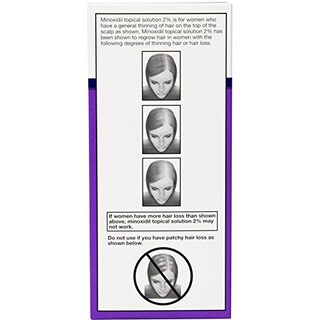 Foto 3 | Foto 3 | Tratamiento para el Cabello Equate 60 ml para Mujer-Venta Internacional