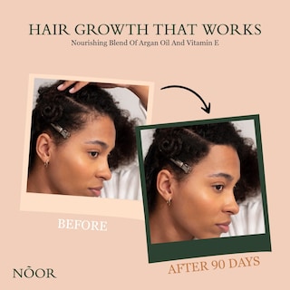 Foto 3 | Foto 3 | Sérum Para El Crecimiento Del Cabello Noor Hair Para Mujeres Con Aceite De Oliva Africano - Venta Internacional.