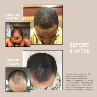 Foto 5 | Foto 5 | El Sérum Para El Crecimiento Del Cabello Mantiene El Minoxidil 5% Extra Fuerte Para Hombres - Venta Internacional.